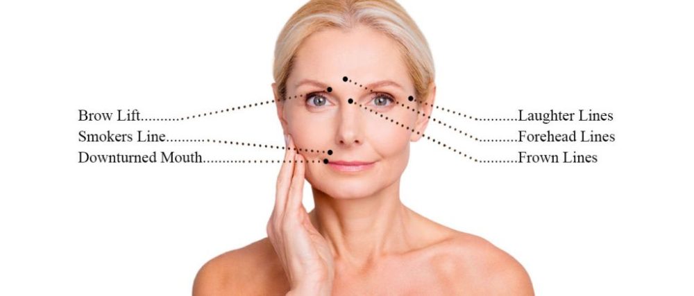 anti wrinkle injections at top clinic near me